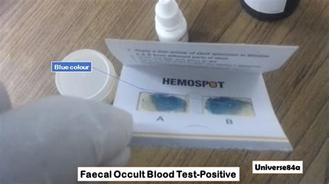 Heme Occult Test: Is It Painful or Uncomfortable?